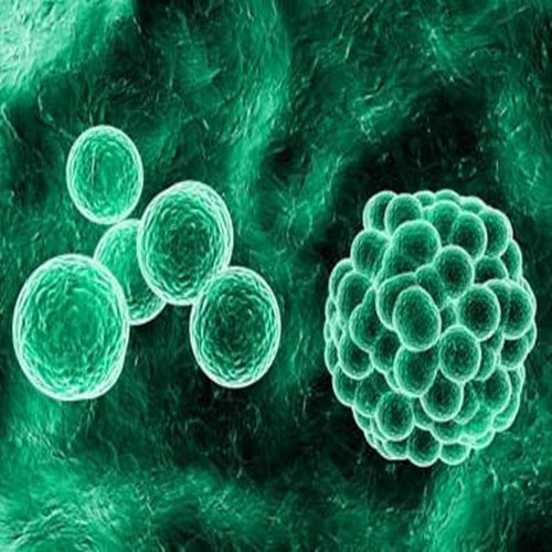 纽约爆发军团菌病 杀伤力极强如何预防？