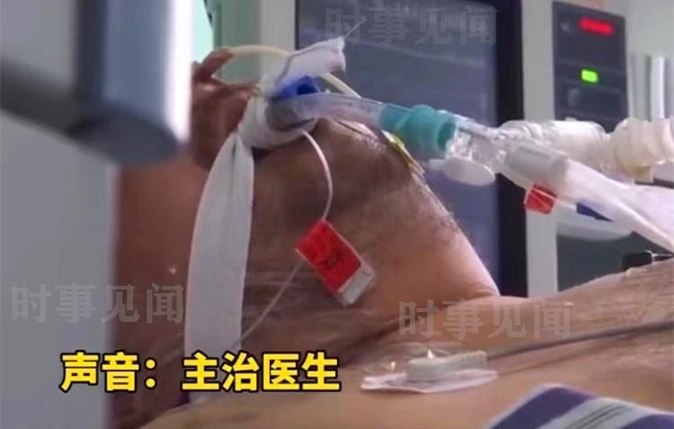 湖北一男子吹空调住进了ICU，插上了呼吸机，医生：空调太脏了 